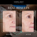 Smoother eye-area skin after sessions in Kore ELITE Light Therapy Beds, shown in a before and after comparison