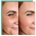 Crow's feet and under-eye creases beside smoother, firmer skin for the KoreLight KoreMask Light Therapy Mask