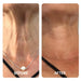 Neck and chest skin firming before and after results from Galaxy Zero Capsule Red Light Therapy sessions