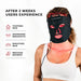 Woman wearing the Lumara VISO Face Mask beside a list of skin changes users report after two weeks