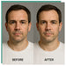 Calmer, even skin tone on a middle-aged man after KoreLight KoreMask LED Face Mask sessions versus forehead redness